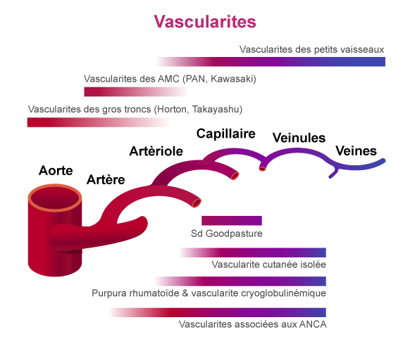 Classification des vascularites